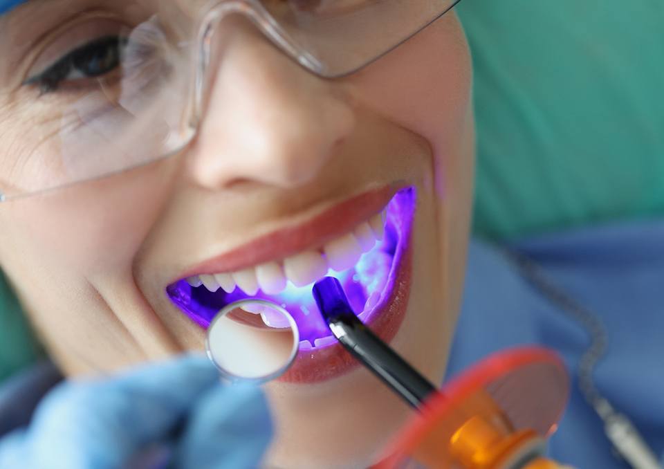 Patient receiving dental sealants in Richardson